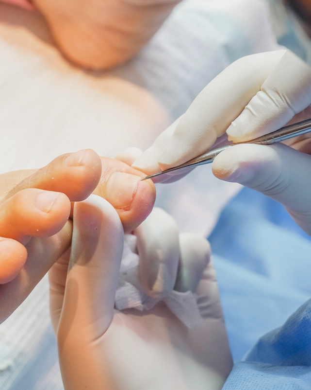 podologia preventiva