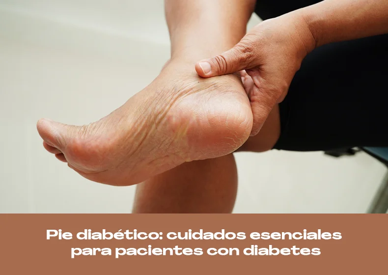 Pie diabético: cuidados esenciales para pacientes con diabetes