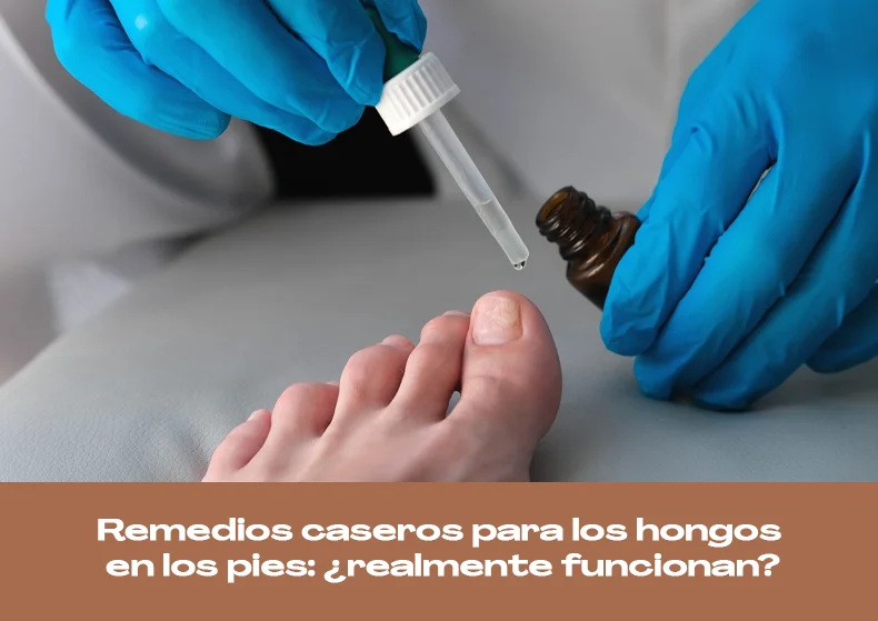Remedios caseros para los hongos en los pies: ¿realmente funcionan?
