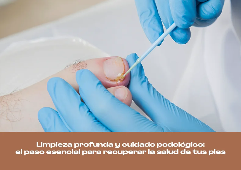 Limpieza podológica para eliminar hongos y cuidar tus pies