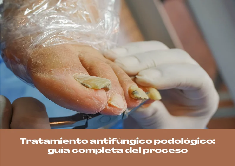 Tratamiento antifúngico podológico: guía completa del proceso profesional