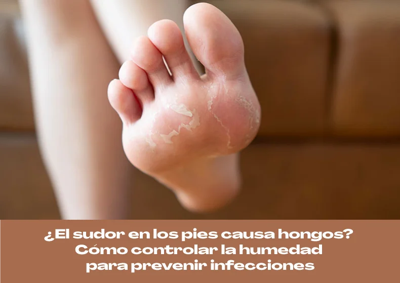 ¿El sudor en los pies causa hongos? Controla la humedad para prevenir infecciones