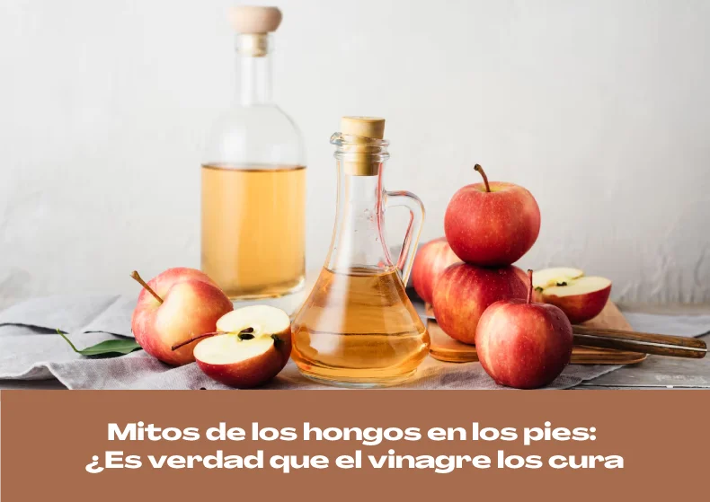 Mitos de los hongos en los pies: ¿Es verdad que el vinagre los cura?