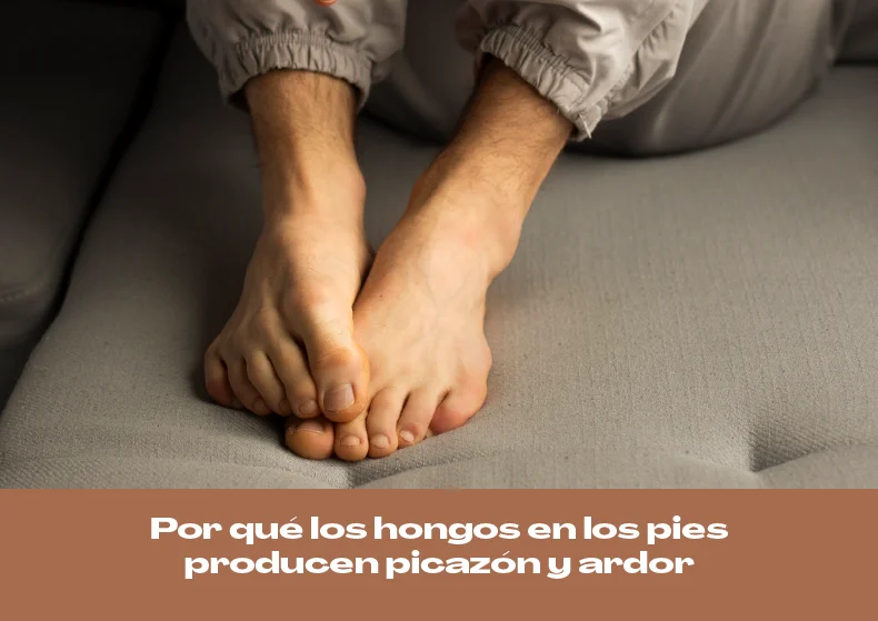 ¿Por qué los hongos en los pies producen picazón y ardor?