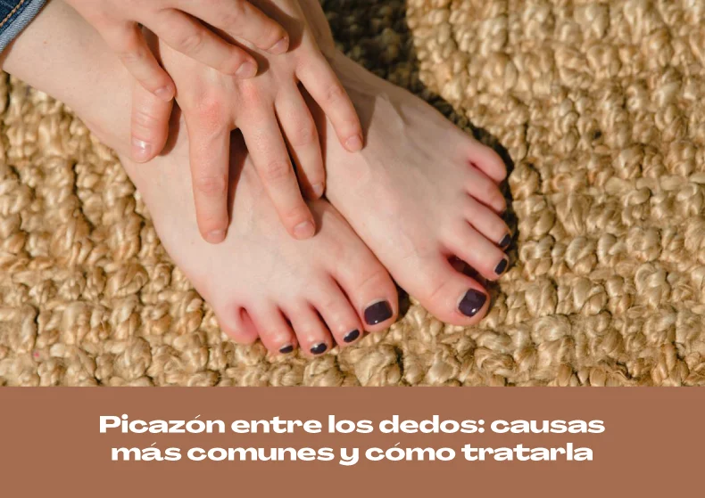 Picazón entre los dedos: causas más comunes y cómo tratarla