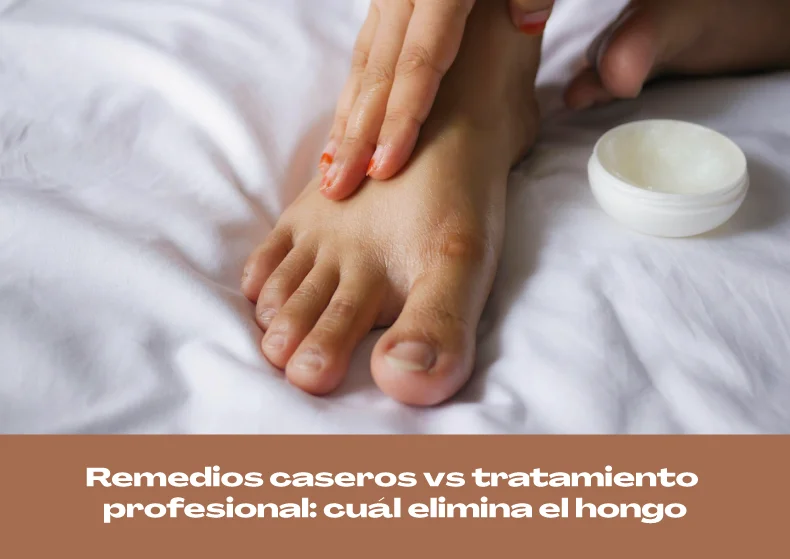 Remedios caseros vs tratamiento profesional: cuál elimina el hongo