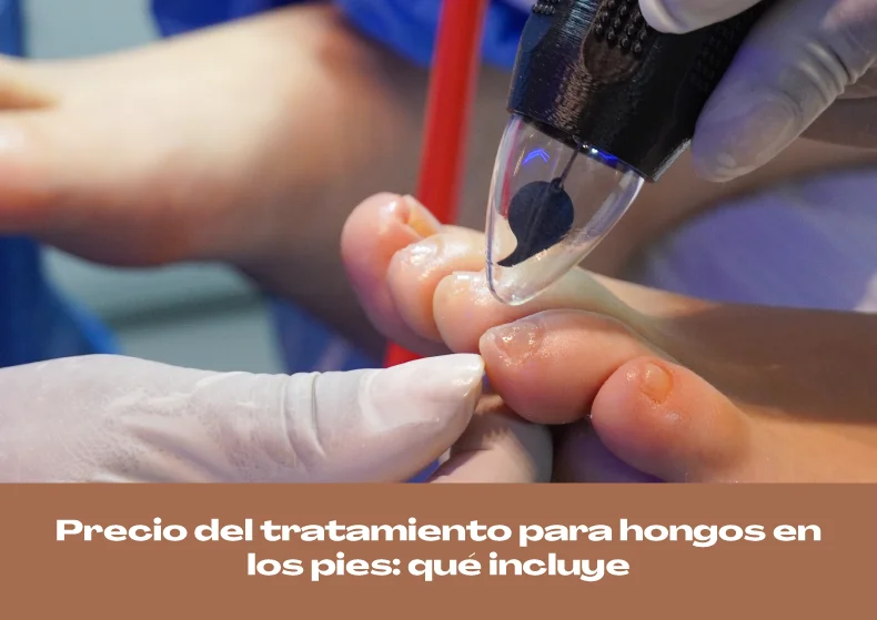 Precio del tratamiento para hongos en los pies: qué incluye