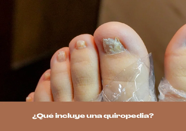 Qué incluye una quiropedia: todo lo que debes saber