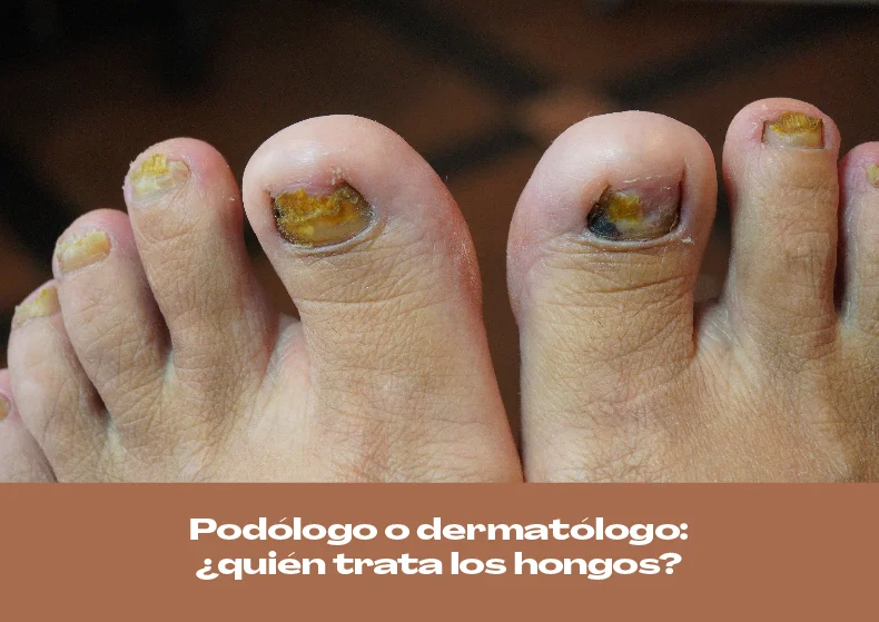 Diferencia entre pedicure y podología: ¿cuál necesitas?