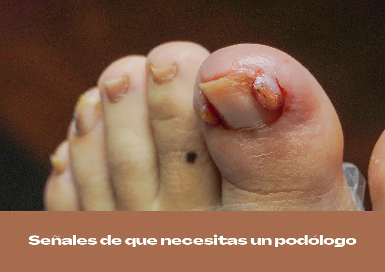 Señales de que necesitas un podólogo: checklist rápido